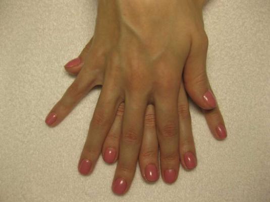 Shellac nedir?