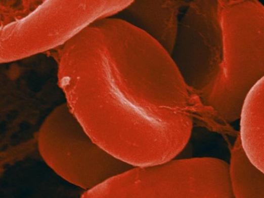 Düşük hemoglobin tehlikesi nedir?